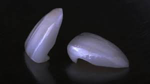 VENEERS---DENTAL-VENEERS--PORCELAIN-VENEERS-MELBOURNE--SPECIALS-AND-PACKAGES