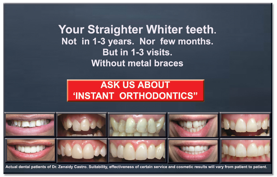 VENEERS---DENTAL-VENEERS--PORCELAIN-VENEERS-MELBOURNE--SPECIALS-AND-PACKAGES