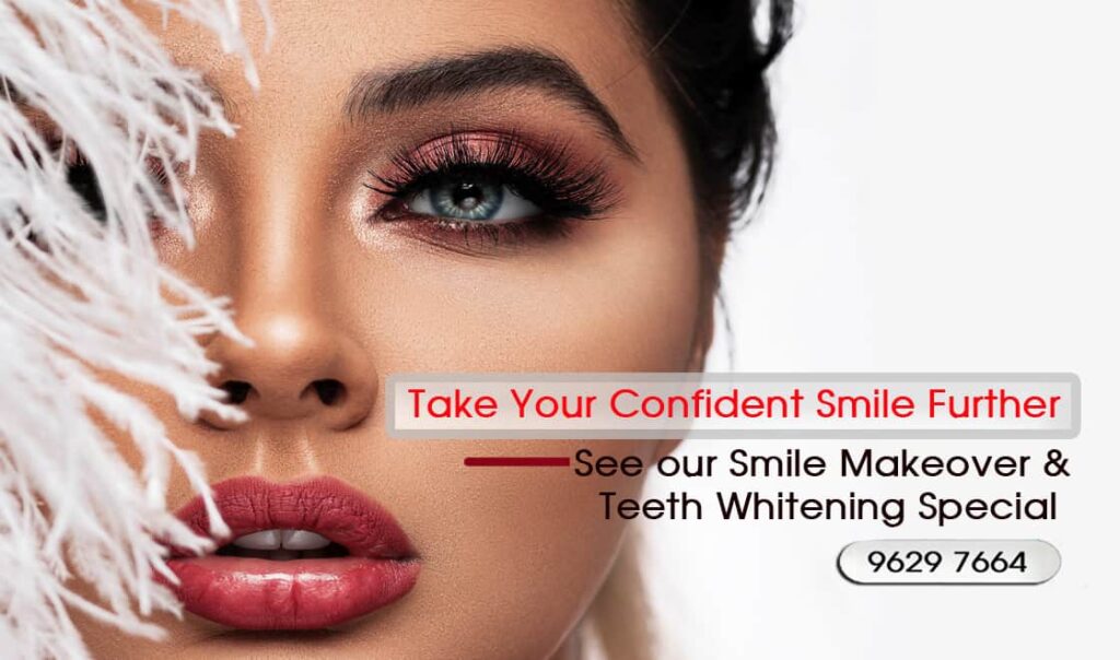 Porcelain-Veneers-Melbourne-CBD-Best-Cosmetic-Dentist